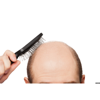 Hair Transplant in Delhi logo, Hair Transplant in Delhi contact details