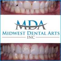 Midwest Dental Arts logo, Midwest Dental Arts contact details