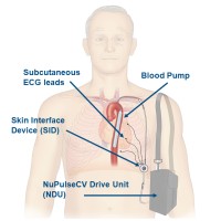 NuPulseCV logo, NuPulseCV contact details