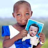 Operation Smile South Africa logo, Operation Smile South Africa contact details