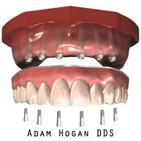 Full Implant Choice logo, Full Implant Choice contact details