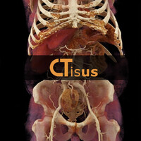 CTisus logo, CTisus contact details