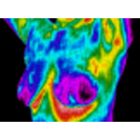 The Breast Thermography Institute logo, The Breast Thermography Institute contact details