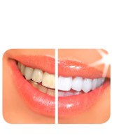 Davinci Laser Teeth Whitening logo, Davinci Laser Teeth Whitening contact details