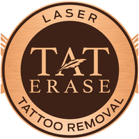 Tat Erase logo, Tat Erase contact details