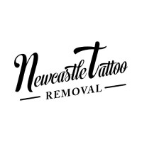 Newcastle Tattoo Removal logo, Newcastle Tattoo Removal contact details